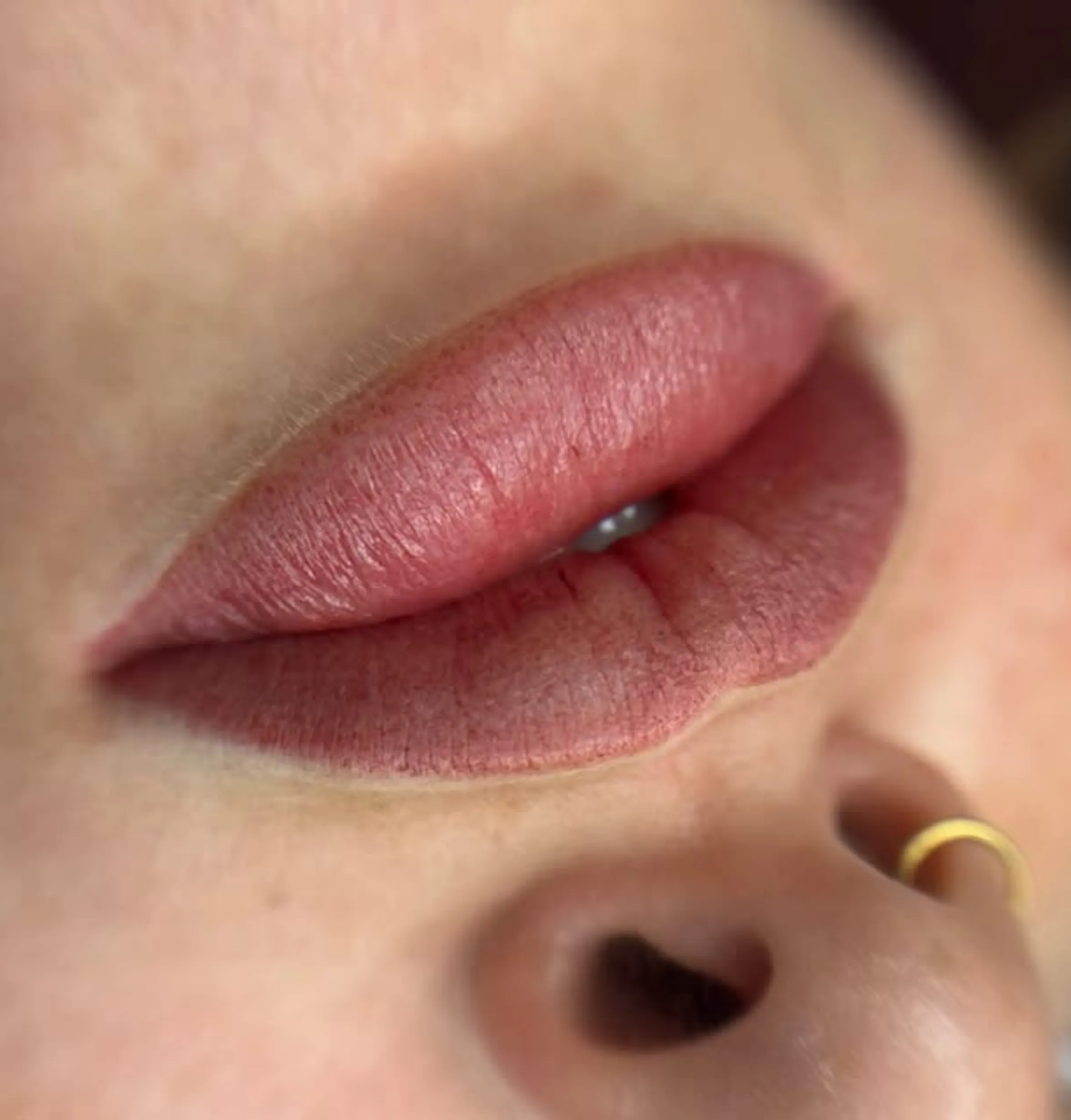 herpes simplex virus lip tattoo